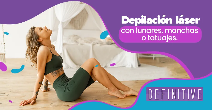 Depilación láser con lunares, manchas o tatuajes