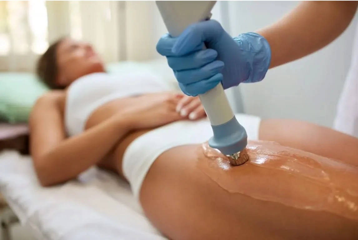 Tratamiento X-Wave con ondas acústicas para celulitis y piel